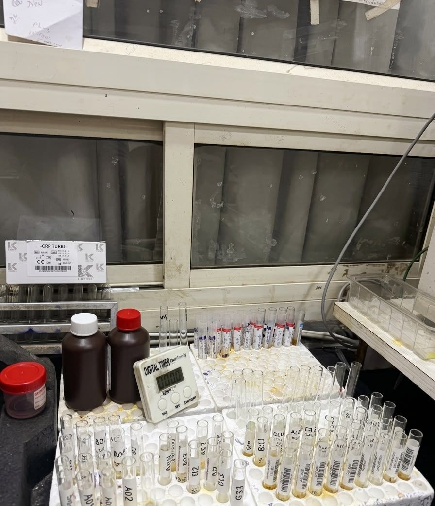 Sample tubes processing